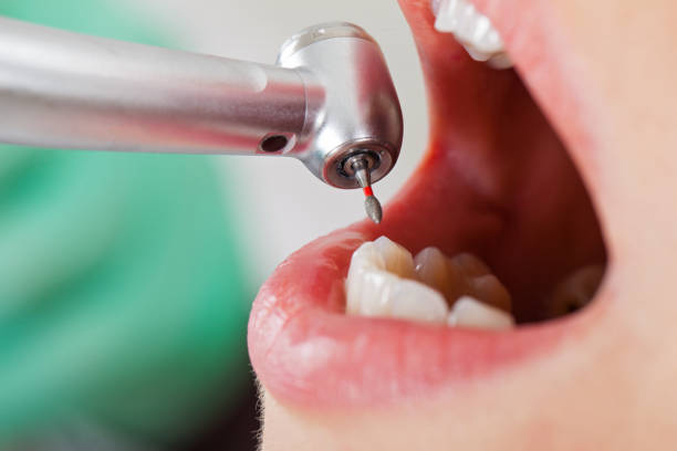 Best Emergency Dental Care for Trauma or Injury in Westport, WA